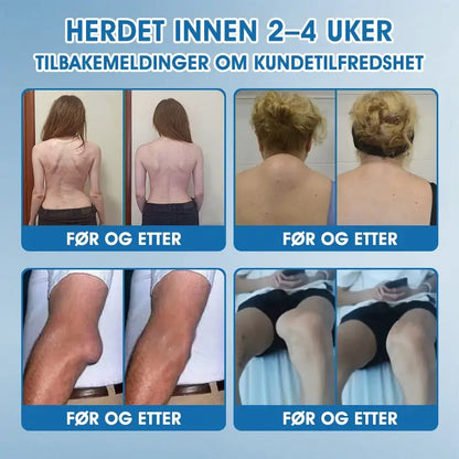 | 𝐒𝐢𝐬𝐭𝐞 𝐝𝐚𝐠! 𝟖𝟎 % 𝐑𝐀𝐁𝐀𝐓 🥇| 𝐂𝐫𝐨𝐚𝐢𝐞® 𝐁𝐏𝐂-𝟏𝟓𝟕 𝐋𝐞𝐝𝐝𝐡𝐞𝐥𝐞𝐧𝐝𝐞 𝐊𝐫𝐞𝐦 🇳🇴🦴  Behandler artritt, nevropati, revmatisme, idrettsskader og mer 🏆